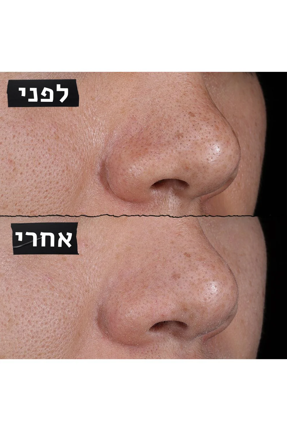 תמונת מוצר 6